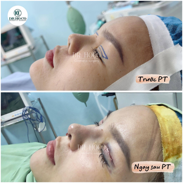 Slider image (4) Dr. Ho Co - Aesthetics and Plastic Surgery in Vietnam